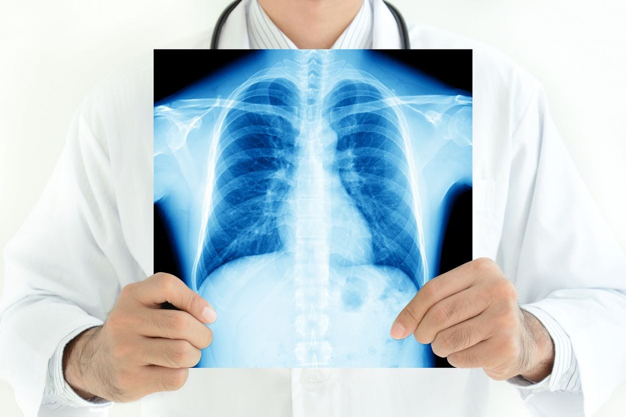 a doctor holding an xray report